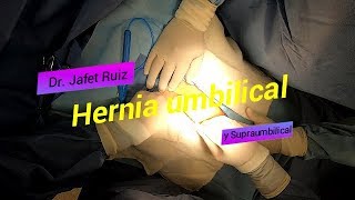 Eduardo Jafet Ruiz Suárez-18