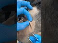 #waxing #ingrownhair #trending #hair #beard #remove #asmr #maazsafder #hairremoval #natural NK.0155