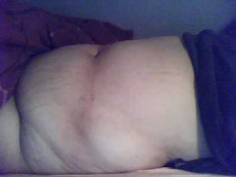 belly inflation