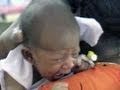Global Activists Seek Improved Nutrition for Pregnant Women, Infants