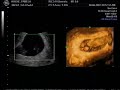 First ultrasound - it\