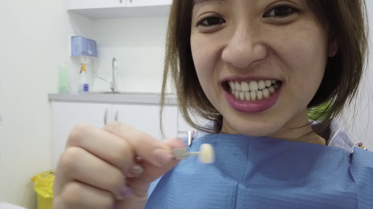 Philips Zoom! Whitening at Lau Dental | Queenzy Cheng VLOG