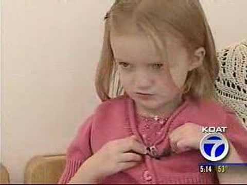 Cleft Palate