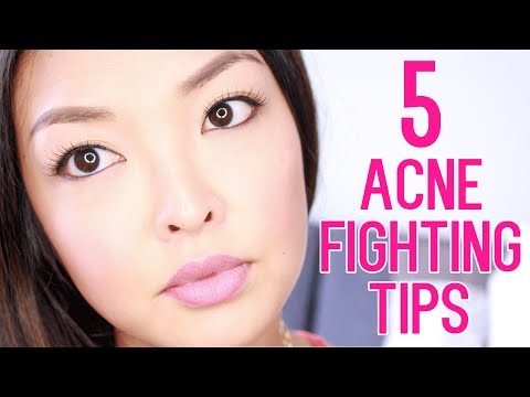 how to get rid of acne scars fast z