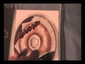 Red Seeds Profile AKA Deadly Premonition unboxing