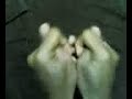 77