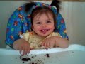 Class Three Overbite - \"Life is a Piece of Cake\" Class Three Overbite - \"Life is a Piece of Cake\"