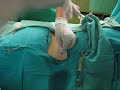 percutaneous nephrostomy