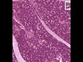 Shotgun Histology Submandibular Gland Shotgun Histology Submandibular Gland