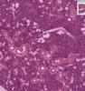 Shotgun Histology Submandibular Gland