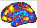 spontaneous brain activity (i)