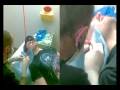 videos de ear reconstruction 29th nov 08