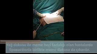 Gökhan Özerdem-70