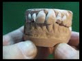 Mandible CR Interferences