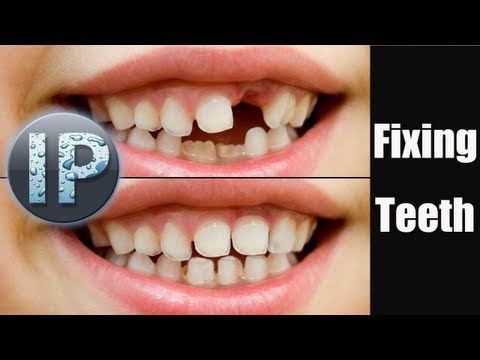 how to whiten teeth in adobe photoshop elements 10