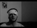 HEAD WOUND HEAD WOUND