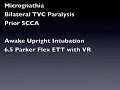 Awake Upright Video Rigid Flexible Laryngoscope (RIFL) intubation - no oral airway