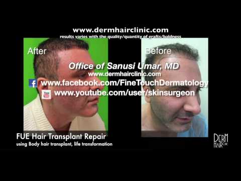 how to repair hair follicles