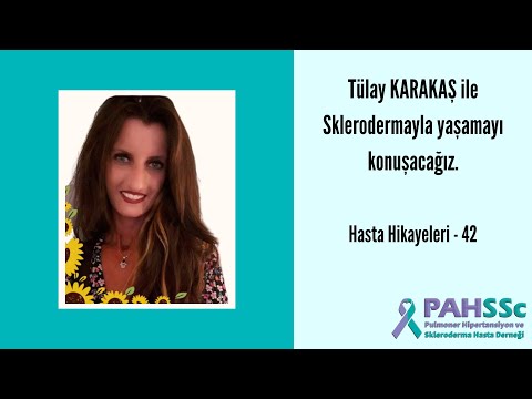 Hasta Hikayeleri - Tülay KARAKAŞ ile Sklerodermayla Yaşamak - 42- 2021.06.15