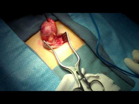how to remove umbilical cord from puppies