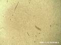 videos de Chameleon Blood Showing Live Microfilariae Parasites Part 2