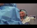 Awake Tumescent Liposuction with Smartlipo Laser
