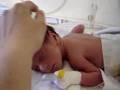 one week premature infant