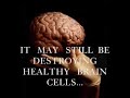It's Like Being Drunk Without Drinking- chemo brain