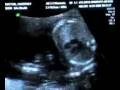 JillAndHankBabyUltraSound