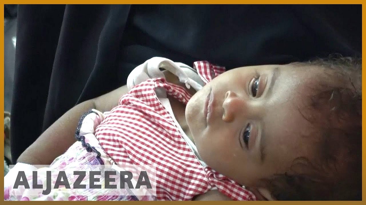 Saudi-led War on Yemen has Killed 56,000, 5x more than Thought: Study
