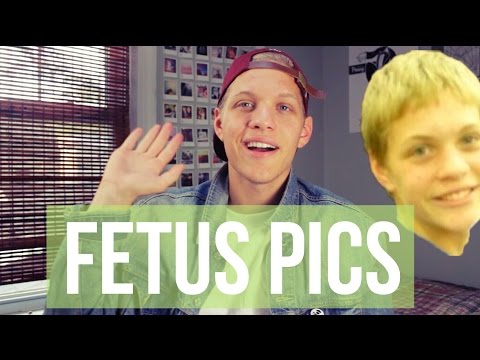 photos