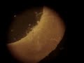 Nematostella vectensis (sea anemone)