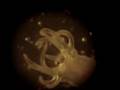 Nematostella vectensis (sea anemone)