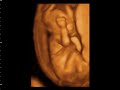 Bebe 15 semanas video #2 Bebe 15 semanas video #2