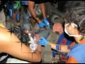 Cadiz rescue brgy. tilawigan v.a.