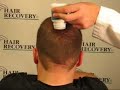 Fibras Capilares Hair Recovery - Cabello en Segundos 1 Fibras Capilares Hair Recovery - Cabello en Segundos 1