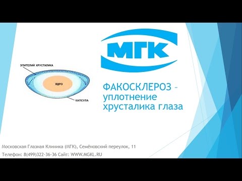 Видео Уплотнение хрусталика