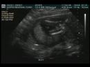 Baby Boy Silkey
