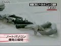 Laptop PC explodes in Korea