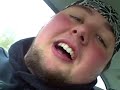 MORBID OBESITY