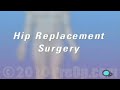 PreOp® Patient Education Hip Replacement