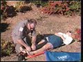 Applying Sager Traction Splint