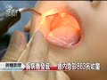 Click here to watch this video 20120522 - 腸病毒發威一週內急診逾800人- 二氧化氯消毒專家.flv