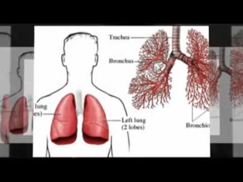 how to cure acute bronchitis
