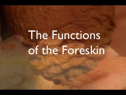 adult circumcision - An excerpt from the feature-length documentary film Cut:Slicing Through the Myths of Circumcision. To watch the entire film, please visit: www.CutTheFilm.com.