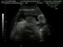 Leonardo Rondina Salgado 38 semanas