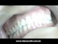 Como usar o fio dental da maneira correta