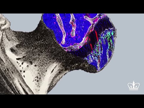 how to rebuild cartilage
