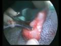 gastropessi preventiva laparo-assistita cane. Vittorio Garbagnoli
