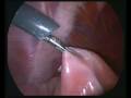 gastropessi preventiva laparo-assistita cane. Vittorio Garbagnoli